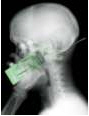 Scientists Say Cell Wireless Phones Harmful, Call for Safety Standards Scientists Say Cell Wireless Phones Harmful, Call for Safety Standards